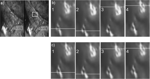 Figure 3. (a) Original video image frames from a TECAB sequence. (b) The corresponding magnified time frames from the region marked by the white square in (a). (c) HR reconstructions calculated using the described POCS method. White lines in b and c indicate rows for which intensity profiles are shown in Figure 4.