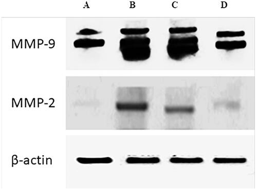 Figure 4. Western blot analysis: (A) protein expression in untreated control group; (B) protein expression in UVB-treated group; (C) protein expression in UVB and LAA solution treated group; (D) protein expression in UVB and LAA-loaded spanlastics treated group in skin biopsies.