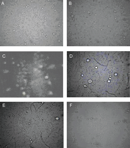 Figure 2.  Optical microscopy photomicrographs of elastic liposomal formulation (without sonication) at different surfactant concentrations EL-SP1 (a), EL-SP2 (b), EL-SP3 (c), EL-SP4 (d), EL-SP5 (e), EL-SP6 (f) (Magnification 450×).