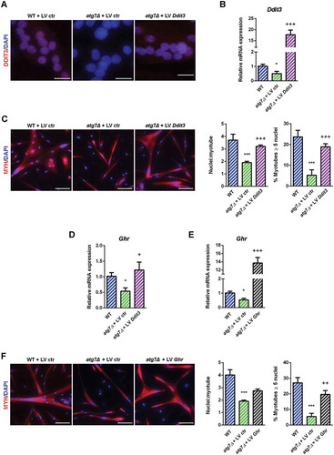 Figure 10. Rescue of DDIT3 and GHR restored myogenic capacity of atg7Δ nSCs. WT and atg7Δ nSCs were infected with control lentivirus (LV ctr) or lentivirus expressing DDIT3 (LV Ddit3) or GHR (LV Ghr). (a) Representative DDIT3 nuclear immunostaining (red) and DAPI nuclear counterstaining (blue) (scale bar: 25 µm). (b) RT-qPCR analysis of Ddit3 after lentivirus infection (n ≥ 4 per treatment). (c) Representative MYH immunostaining (red) and DAPI nuclear counterstaining (blue) (scale bar: 50 µm). Mean number of nuclei/myotube and percentage of myotubes with nuclei number ≥ 5 are provided (n = 3 per treatment). (d) RT-qPCR analysis of Ghr after infection with LV Ddit3 of atg7Δ nSCs (n = 3 per treatment). (e) RT-qPCR analysis of Ghr after infection with LV Ghr of atg7Δ nSCs (n = 3 per treatment). (f) Representative MYH immunostaining (red) and DAPI nuclear counterstaining (blue) (scale bar: 100 µm). Mean number of nuclei/myotube and percentage of myotubes with 5 or more nuclei are provided (n = 3 per treatment). * vs WT nSCs infected with LV ctr (* P < 0.05, *** P < 0.001); + vs atg7Δ nSCs infected with LV ctr (+ P < 0.05, ++ P < 0.01, +++ P < 0.001). Values are expressed as mean ± SEM.