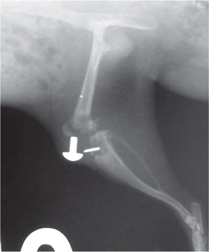 Figure 3. Severe inflammation with loosening of the prosthesis and bone destruction. S. aureus strain MN8, 104 CFU (score = 13).