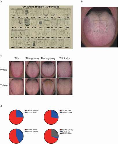 Figure 1. Example of traditional Chinese medicine tongue type classification and tongue-coating classification of our participants. (A) Thirty-six tongue types presented in the ancient medical book of Ao Shi Shang Han Jin Jing Lu (1341 A.D.). (B) Diagnosis and sampling site of the tongue dorsum. (C) Examples of eight tongue coating types (upper from left to right: white thin, white thin greasy, white thick greasy, white thick dry; lower from left to right: yellow thin, yellow thin greasy, yellow thick greasy, yellow thick dry). (D) Proportion of sex and specific tongue coating characteristics in the recruited healthy population