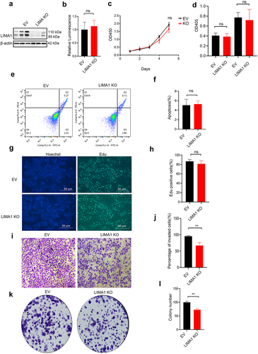 Figure 4. Lima1 KO inhibits RBE cell invasion in vitro.