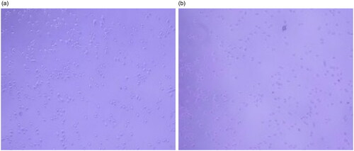 Figure 7. Bright field image of HepG-2 treated with (a) free ICG and (b) Ag-Au-ICG in 1% Intralipid for 2 h.