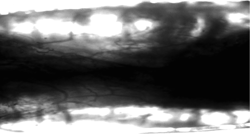 Figure 5 Regenerated nerve fiber in conduit and vessel on the conduit 10x.