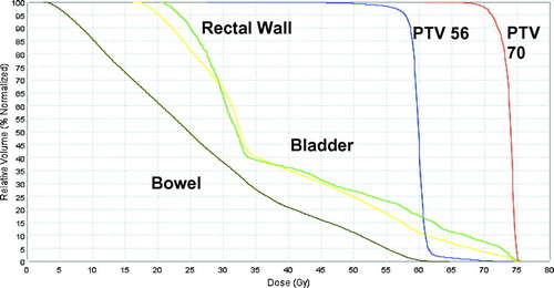 Figure 3.  Physical dose DVH from patient 2 (Tomotherapy Plan)