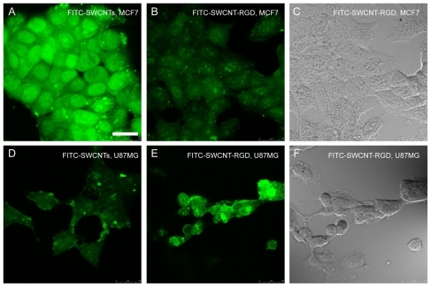 Figure 3 Confocal microscopic images of MCF7 cells (A, B and C) and U87MG cells (D, E and F) incubated with FITC-SWCNT (A and D) and FITC-SWCNT-RGD (B, C, E and F). (A) and (F) are the bright view images of (B) and (E), respectively. The green fluorescent signals indicate the location of FITC-SWCNT (A and D) and FITC-SWCNT-RGD (B and E) in the cells. Scale bar: 25 μm.Abbreviations: RGD, cyclic arginine-glycine-aspartic peptide; SWCNT, single-walled carbon nanotubes; FITC, fluorescein isothiocyanate.