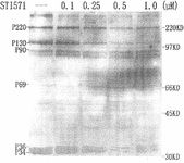 Figure 3 Immunoblotting analysis of the protein tyrosine phosphorylation of concentrations of STI571 on K562 cells for 12 h. Exposure of K562 cells to STI571 for 12 h resulted in a decrease in the tyrosine phosphorylation of the same proteins affected by matrine. Positions of molecular mass markers are shown to the right (in kilodaltons). Each experiment was repeated two times and similar results were obtained.