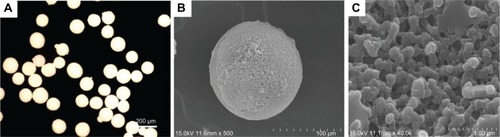 Figure 3 Microscopic images of Fbg microspheres.Notes: (A) Light microscope image shows the microsphere sphericity and approximately uniform sizes, between 100–150 μm; (B) SEM image further confirmed sphericity; (C) Magnified image of (B), reveals the porous structures. Copyright © 2011, Springer Science+Business Media. Reproduced with permission from Rajangam T, Paik HJ, An SSA. Development of fibrinogen microspheres as a biodegradable carrier for tissue engineering. BioChip J. 2011;5(2):175–183.Citation9Abbreviations: Fbg, fibrinogen; SEM, scanning electron microscope.