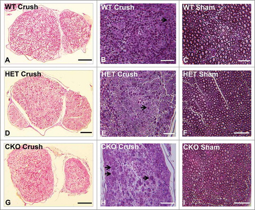Figure 4. Qualitative effect of GDNF on sciatic nerve morphology on day 7 following crush injury. Representative digital light photomicrographs from the sciatic nerves of experimental mice 7 days following sciatic nerve crush injury at low (A, D, G) and high magnification (B, E, H) show increased axonal density in GDNF WT (A, B) and HET (D, E) mice compared to CKO mice (G, H) which demonstrates more myelin debris with evidence of active Wallerian degeneration (black arrows), consistent with previous reports demonstrating a protective role for GDNF following axonal injury. Uninjured sham surgery control nerves (C, F, I) from the same mice are also shown. Scale bars = 25 µm (C), 50 µm (B, E, F, H, I) and 200 µm (A, D, G).