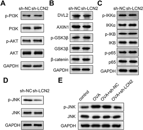 Figure 5 Knockdown of lipocalin 2 (LCN2) inactivates the janus kinase (JNK) pathway. Effects of LCN2 knockdown on the (A) PI3K/AKT pathway, (B) Wnt/β-catenin pathway, (C) NF-κB pathway, and (D) JNK pathway-related factors in lung tissue samples were evaluated using Western blotting. (E) Protein levels of p-JNK and JNK were detected in the lung tissue samples of mice from all groups using Western blotting; n=6.