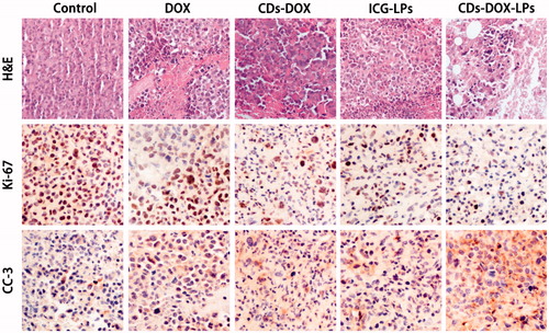 Figure 5. Morphological evaluation in H&E sections of tumor sites (first panel). In vivo evaluation of tumor proliferation level by Ki-67 immunohistochemistry (second panel) (proliferation cells shown brown pixel dots). Evaluation of the apoptosis behavior of different formulations by CC3 immunohistochemistry (third panel) (brown pixel in cytoplasm represents the apoptosis level).
