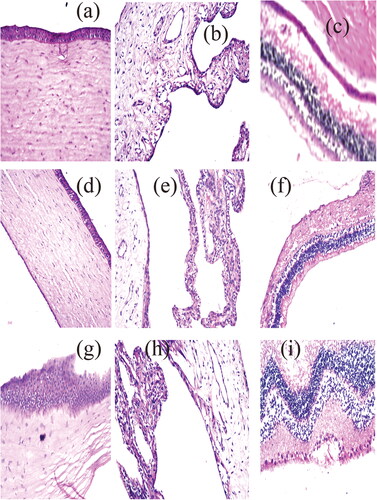 Figure 3. represt photomicrographs of histopathological sections of rabbit cornea, iris, retina, choroid, and sclera treated with: (a–c) negative control, (d–f) OB formula formula, and (g–i) agomelatine solution.