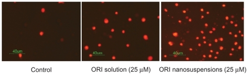 Figure 3 The effect of oridonin nanosuspension on apoptosis morphological change of PC-3 cells (X200).