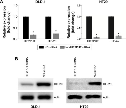 Figure 2 Knockdown of lncRNA-HIF2PUT inhibited the expression of HIF-2α.