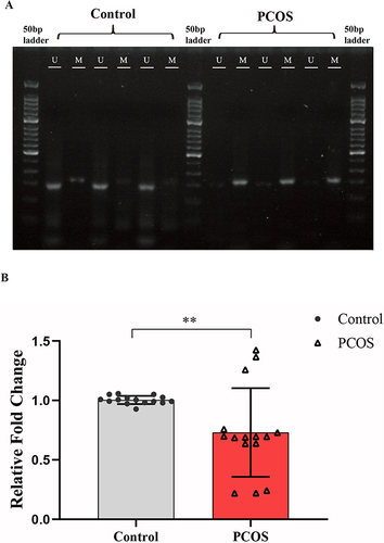 Figure 8 Validation of the promoter methylation and gene expression levels of TACSTD2. (A) MSP 2% agarose gel electrophoresis results; (B) RT-qPCR of TACSTD2 in PCOS patients GCs vs control groups GCs (**P<0.01).