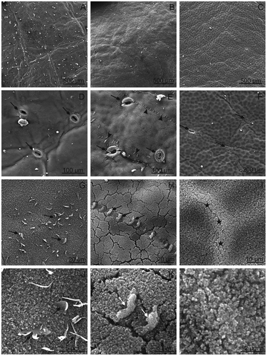 FIGURE 1 SEM. Surface of the Prunus fruits; A, D, G, J—“Bluefre;” B, E, H, K—“Sweet Common Prune;” C, F, I, L—“President.” Visible microwrinkles (A, C) and undulations (B) centered around the stomata. D–F—visible wax platelets (E; arrow heads) and stomata (D–F; arrows) surrounded by wrinkles. G–L—visible crystalline wax in the form of vertical plates (arrows; G, H, J, K) and microgranules (I–L), and numerous microcracks in the wax layer (H, K), asterisks—wax microgranules in high density.