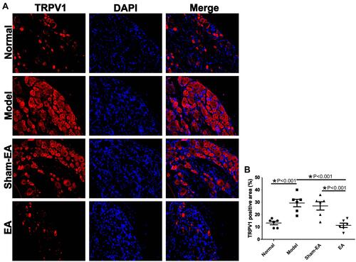 Figure 8 Effects of EA on the expression of TRPV1 in S2-S3 dorsal root ganglions (DRGs). (A) The expression of TRPV1+ ganglion cells in different groups. Scale bar=50 μm. (B) The quantitative expression of TRPV1+ ganglion cells in different group. *P<0.05.