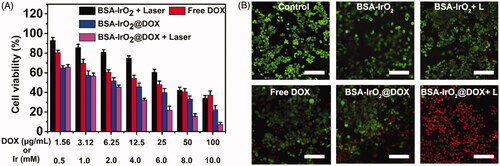 Figure 5. In vitro cell experiments. (A) Relative viabilities of Saos-2 cells after treatment with various groups. (B) Corresponding images of Saos-2 cells stained with calcein AM (live cells, green fluorescence) and PI (dead cells, red fluorescence). Scale bars = 200 µm.
