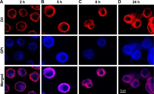 Figure 9 Localization of the nanoplatform in cells. HSC3 was incubated with GPt (1 μM) for 2, 5, 8, and 24 hours, respectively (A–D). Cell membranes were stained in red with Dil dye, and the blue luminescence of GPt was excited at 405 nm under CLSM.Abbreviations: CLSM, confocal laser scanning microscopy; GPt, polyethylene glycol-graphene quantum dots-Pt; Dil, 1,1′-Dioctadecyl-3,3,3′,3′-tetramethylindocarbocyanine perchlorate.