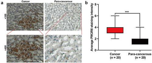 Figure 2. PIK3R6 protein level was upregulated in CCRCC. (a) Representative immunohistochemical images are presented about PIK3R6 expression in CCRCC and paired para-carcinoma tissues. (b) PIK3R6 expression is significantly higher in the CCRCC tissues than that in the paired para-carcinoma tissues (n = 20; ***p < .001).