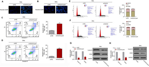 Figure 2 Silencing DLEU2 induces apoptosis and cell arrest at G2/M phase of cervical cancer cells. (A and B) Cells were stained by Hoechst 33,258 for observation of apoptosis in Hela and SiHa cells. (C and D) FITC-Annexin V/PI-staining in DLEU2 silenced Hela and SiHa cells. (E and F) The cell cycle was analyzed 48 h after knockdown of DLEU2 in Hela and SiHa cells by flow cytometry. The expression of cell cycle hallmarks Cyclin D1 and CDK4 was analyzed by qPCR and Western blot in Hela (G) and SiHa (H) cells after knockdown of DLEU2. GAPDH was used as an internal standard. **p<0.01.