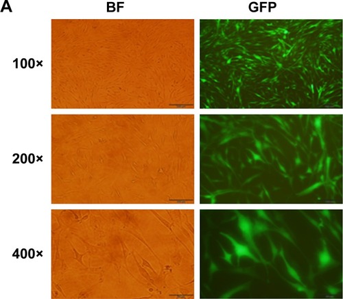 Figure 5 Overexpression of β-catenin antagonizes the effect of tiotropium on collagen I production.