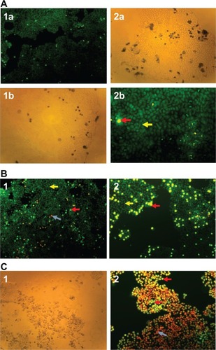 Figure 5 Cells treated with siRNA and oxaliplatin.