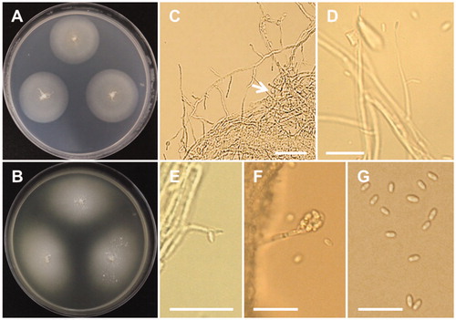Figure 7. Morphology of Gibellulopsis nigrescens CNUFC-DDS47-1. A, Colony on potato dextrose agar; B, Colony on malt extract agar; C, Conidiophores and chlamydospores (white arrow); D–F, Conidia attached to conidiophores; G, Conidia (Scale bars: C–G = 20 μm).