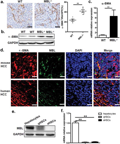 Figure 4. MBL deficiency is associated with an increase of activated HSCs.(a) Analysis of activated HSCs (α-SMA+ immunoreactive area, IRA) in tumor tissue of tumor-bearing WT and MBL–/– mice. Scale bars, 50 μm. α-SMA (b) and its mRNA expression (c) in liver tissue were analyzed by immunoblot assay and RT-PCR, respectively. (d) Immunofluorescence analysis of co-localization of MBL (green) andα-SMA (red) in situ in tumor tissues of WT mice and HCC patients. Scale bars, 25 μm. Quiescent HSCs (qHSCs) were separated from the normal WT mouse liver as described in Materials and Methods. Activated HSCs (aHSCs) were obtained by culture qHSCs with Hepal-6-CM. MBL (e) and its mRNA expression (f) in qHSCs and aHSCs were analyzed by immunoblotting and quantitative RT-PCR, respectively. Hepatocytes served as a positive control. The data representative of more than three independent experiments with similar results are shown.