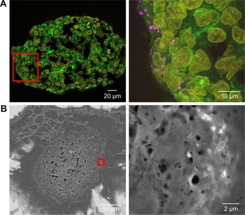 Figure 8 Distribution of SiO2 NPs in HepG2 spheroids during spheroid formation.Notes: 100 µg mL−1 SiO2 NPs were applied at day 2 after seeding for 5 days. For imaging, spheroids were fixed and cut into 10-µm-thick cryoslices. Representative images of the samples are shown. (A) CLS images of the spheroids. After the preparation of cryoslices, samples were stained for CLS microscopy. The cell nucleus (yellow), cytoskeleton (green), and SiO2 NPs (magenta) are imaged. Red box indicates the detailed image position, which is derived from a maximum projection, shown on the right. (B) Back-scattered electron micrographs of a spheroid overview (left) and a detailed image (right) are shown. Red box indicates the detailed image position on the right.Abbreviations: CLS, confocal laser scanning microscopy; NPs, nanoparticles.
