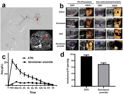 Figure 3. (a) Representative rabbit hepatic DSA images revealed a typical ‘tumor staining (red arrowhead)’, and postembolization serial CT images evidenced of deposited iopamidol (red arrowhead, inserted image). (b) Typical CDFI and CEUS images of VX2 tumors in saline, ATO, sevelamer, and sevelamer arsenite nanoparticles before and 7 days after the procedure. (c) Measurements of plasma arsenic levels at different time points by ICP-MS. (d) Intratumoral Pi concentrations in tumor resected from the ATO and sevelamer arsenite groups.