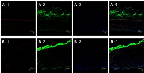 Figure 8 CLSM images show a cross-section image of a porcine intestine stained with DAPI and treated with Nile red-loaded NBD-PE-labeled microemulsion particles after 4 h from different areas (A) and (B). Each image is divided into four frames as follows: (1) red fluorescence of Nile red, (2) green fluorescence of NBD-PE, (3) blue fluorescence of DAPI and (4) overlay of 1, 2 and 3. The scale bar represents 50 µm and 100 µm for A and B, respectively.