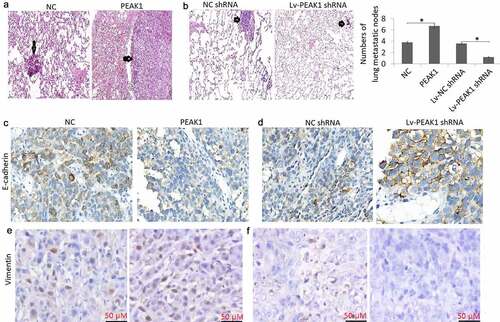 Figure 4. PEAK1 plays a critical role in lung metastasis in melanoma cells in vivo