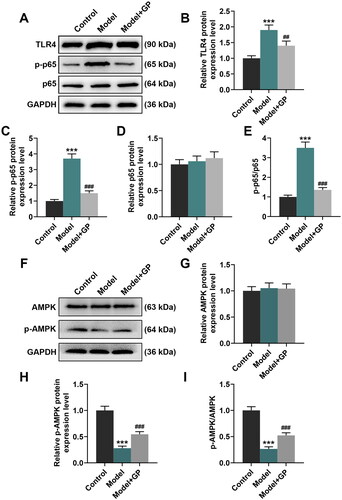 Figure 5. GP counteracted HFD/HF-induced TLR4/NF-κB activation and AMPK inhibition in rats. The protein expression of TLR4, p-p65, p65 (A–D), AMPK and p-AMPK (F–H) in the livers of HFD/HF-fed Wistar rats receiving GP treatment (300 mg/kg) or not was analysed by Western blots, with GAPDH serving as a reference gene. Ratios of p-p65 to p65 (E) and p-AMPK to AMPK (I) in the livers of HFD/HF-fed Wistar rats receiving GP treatment (300 mg/kg) or not. GP: gypenosides; TLR4: Toll-like receptor 4; AMPK: adenosine monophosphate activated protein kinase; NF-κB: nuclear factor kappa B; p: phosphorylated. ***p< 0.001 vs. Control;##p< 0.01, ###p< 0.001 vs. Model.