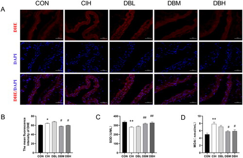 Figure 6. DBD attenuated oxidative stress in the aortas of CIH mice. (A) Representative immunofluorescence staining images of DHE in aortic sections (scale bar = 50 μm). Nuclei are marked in blue and DHE is marked in red. (B) Mean fluorescence intensity of DHE (n = 3). (C) SOD level in serum (n = 6). (D) MDA level in serum (n = 6). Data are expressed as the mean ± SEM. (*p < 0.05 vs. CON group, **p < 0.01 vs. CON group; #p < 0.05 vs. CIH group, ##p < 0.01 vs. CIH group).