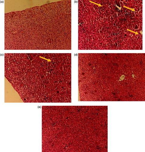 Figure 7. Histopathological images of rat liver segments, (a) indicating intact liver haepatocytes without any necrosis, naïve group; (b) indicating areas of centrilobular necrosis and congestion of centrilobular veins by parasitized erythrocytes (indicated by arrows), negative control; (c) necrotic areas lesser in extent, fewer centrilobular vein congestion, pure drug treated group; (d) and (e) no significant signs of haepatocytic cell necrosis or phagocytic cell hypertrophy, optimized MCT and LCT-SNEDDS treated group.