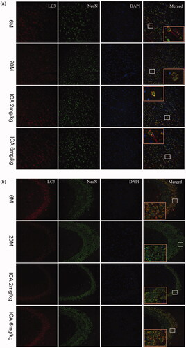 Figure 5. Double-immunofluorescence staining of LC3 and NeuN in cortex (a) and hippocampal CA3 region (b). The expression of LC3 shows in the first column from left; the Neun-labeled neurons shows in the second column; DAPI stains the nucleus and shows in the third column. Compared with 6 M group, the fluorescence intensity of LC3 is significantly reduced in 20 M. After the intervention of ICA, the fluorescence intensity of LC3 increased remarkably. The enlarged image (right) shows the characteristic co-localization image (200×).