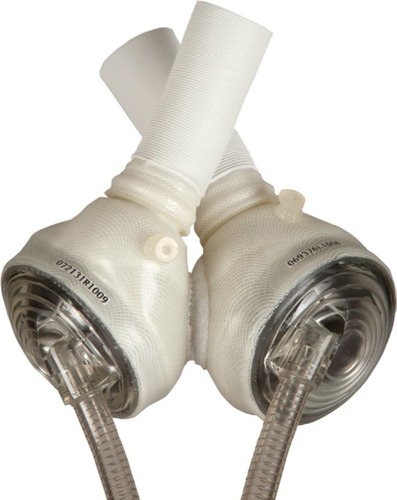 Figure 4 Total artificial heart (Syncardia Systems, Inc.).