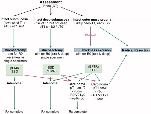 Figure 4. Possible algorithm for treatment of a colonic SPECC lesion. Green lines denote typical pathways, purple lines denote options which can be exercised by patients or clinicians. eT: endoscopic stage assessment.