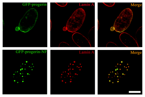 Figure 2. Expression of non-farnesylated progerin alters the nuclear distribution of lamin A in transiently transfected MEFs. Confocal fluorescence micrographs showing localizations of GFP-progerin and GFP-progerin-NF (green signals) and immunofluorescence labeling with anti-lamin A antibodies (red signals) in the same cells; merged images are shown at the right with signal overlap appearing yellow (merge). Bar: 5 µm.