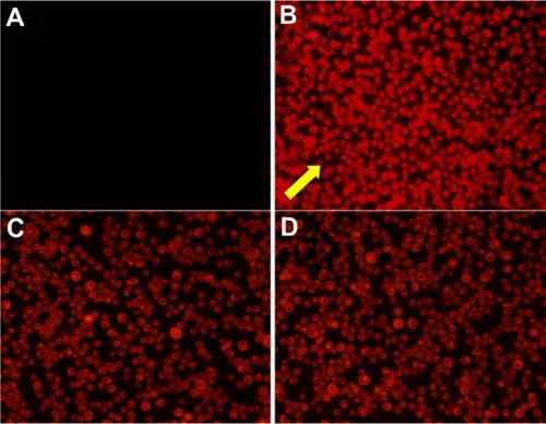 Figure 8 Fluorescence microscope images.Notes: Bel-7402 cells were incubated with different samples. (B–D) set to the same 0.76 μg/mL DOX concentration. Arrow: clear DOX fluorescence in targeted group. (A) PBS control; (B) Targeted group: folate-PEG-P(GA-DIP); (C) Non-targeted group: PEG-P(GA-DIP); (D) The competitive inhibition group: folate-PEG-P(GA-DIP) and 1 mM free folic acid.Abbreviations: DOX, doxorubicin; folate-PEG-P(GA-DIP), folate-poly(ethylene glycol)-b-poly[N-(N′,N′-diisopropylaminoethyl) glutamine]; PBS, phosphate-buffered saline.