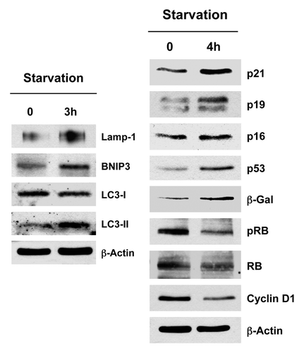 Figure 3. Acute starvation induces markers of autophagy and senescence. After 3 h of acute starvation with Hepes-buffered HBSS, several markers of autophagy were increased (Lamp-1, BNIP3, LC3). Similarly, after 4 h of acute starvation with HBSS, a panel of markers for cell cycle arrest [p21(WAF1/CIP1), p19(ARF), p16(INK4A), p53, β-galactosidase] were all increased. Conversely, markers of cell cycle progression were significantly decreased (phospho-RB and cyclin D1). Blotting with β-actin is shown as a control for equal protein loading.