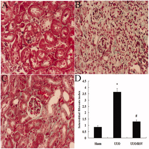 Figure 2. Collagen deposition in mouse kidney subjected to UUO (A–C). The interstitial fibrosis index was determined as described in “Materials and methods” (D). The sham group showed no interstitial collagen deposition (A). The UUO group demonstrated much more collagen deposition and more prominent renal fibrosis at day 14 (B). However, RSV could improve renal fibrosis induced by UUO (C, D). *p < 0.01 versus the sham group; #p < 0.01, UUO versus the UUO/RSV group. Magnification, ×400; Masson’s trichrome staining.