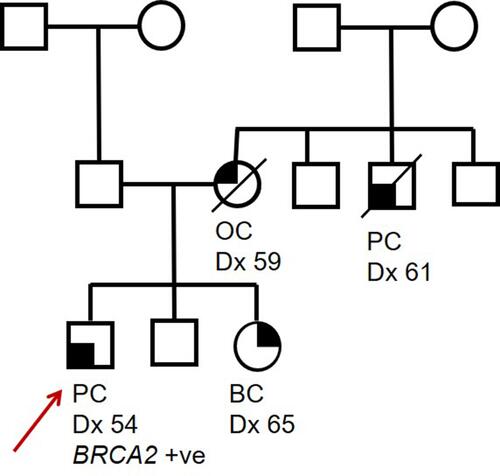 Figure 1 Pedigree of a hypothetical family carrying a pathogenic BRCA2 germline variant. Proband (indicated by red arrow) was diagnosed with PC at 54 years, proband’s sister was diagnosed with BC at 41 years and proband’s mother (deceased) was diagnosed with OC at 59 years. A maternal uncle (deceased) was diagnosed with PC at 61 years. Circles indicate females, squares indicate males. A line through a figure indicates that individual is deceased.
