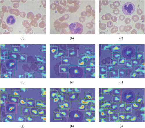 Figure 8. Grad-CAM visualization results on BCCD test set. Top to bottom: (a)–(c) Original image; (d)–(f) Detection results of the baseline model YOLOv5-Nano; (g)-(i) Detection results of the improved model DWS-YOLO.