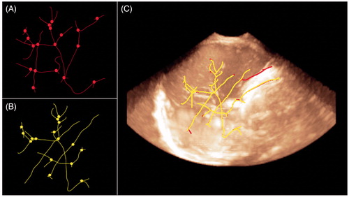 Figure 4. (A, B) Reference image and floating images with vessel centrelines and bifurcation marks, respectively. (C) Registration based on the vessel centrelines; the vessel centrelines of the reference image and the floating images primarily overlapped.