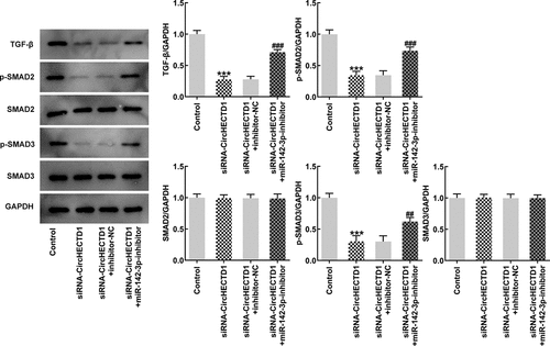 Figure 7. miR-142-3p inhibitor reverses the effect of circHECTD1 knockdown on fibrosis and TGF-β/SMAD signaling. TGF-β, SMADs expression detected by western blot. ***P < 0.001 versus control, ##P < 0.01, ###P < 0.001 versus siRNA-circHECTD1 + inhibitor-NC; n = 3.