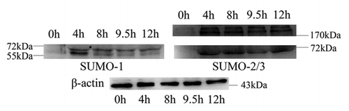 Figure 3 Expression of SUMO-1 and SUMO-2/3 modified proteins during mouse oocyte maturation. Samples were collected after oocyte culture for 0, 4, 8, 9.5 and 12 h, corresponding to the GV, prometaphase I, metaphase I, anaphase I, metaphase II stages, respectively. Proteins from a total of 250 oocytes were loaded for each sample. Experiments were repeated three times.