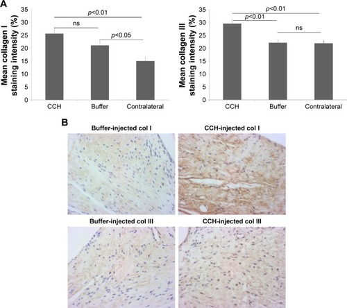 Figure 4 Immunostaining of collagen type I and collagen type III in the posterior capsule from contralateral knees and experimental knees intra-articularly injected with CCH or buffer.